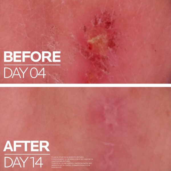 La Roche Posay Cicaplast Baume B5+ balzam za občutljivo kožo