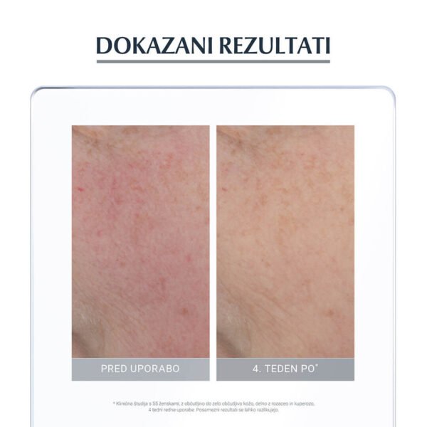 Eucerin nega proti rdečici, 50 ml