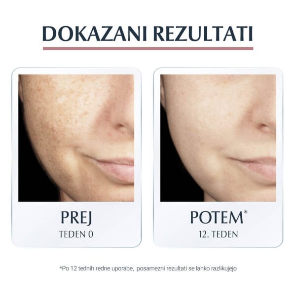 Eucerin Anti-Pigment dnevna nega proti pigmentnim madežem z ZF30, 50 ml