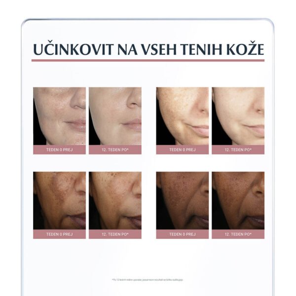 Eucerin Anti-Pigment korektor proti pigmentnim madežem, 5 ml